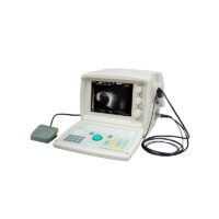 ODM-2100 Ophthalmic untrasonic AB Scanner